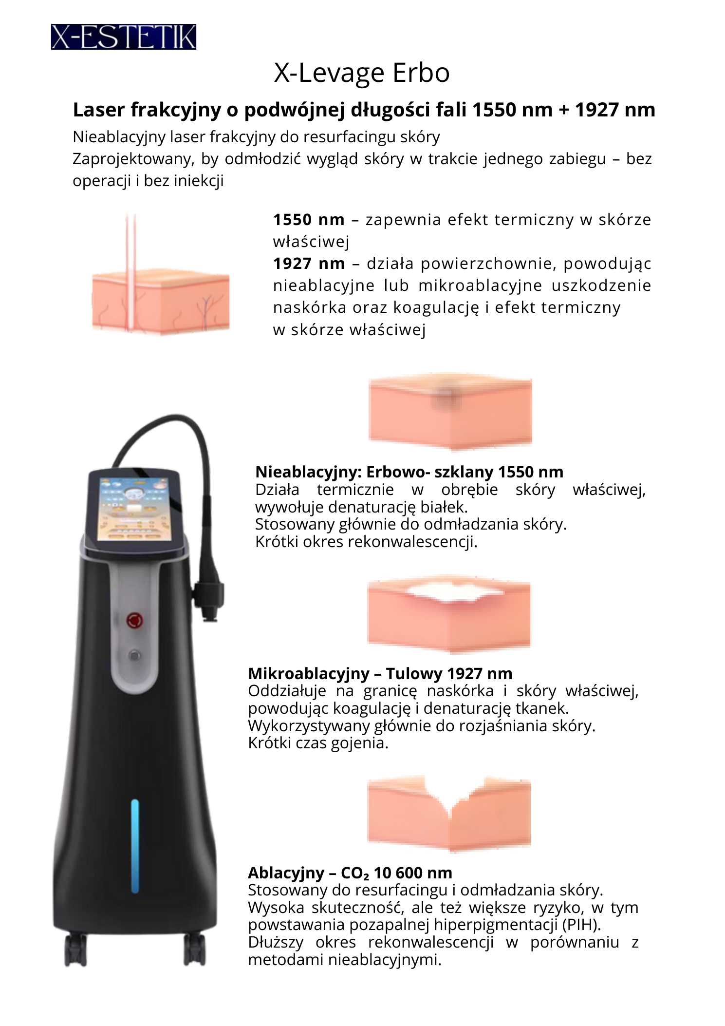 X‑Levage Erbo — opis technologii