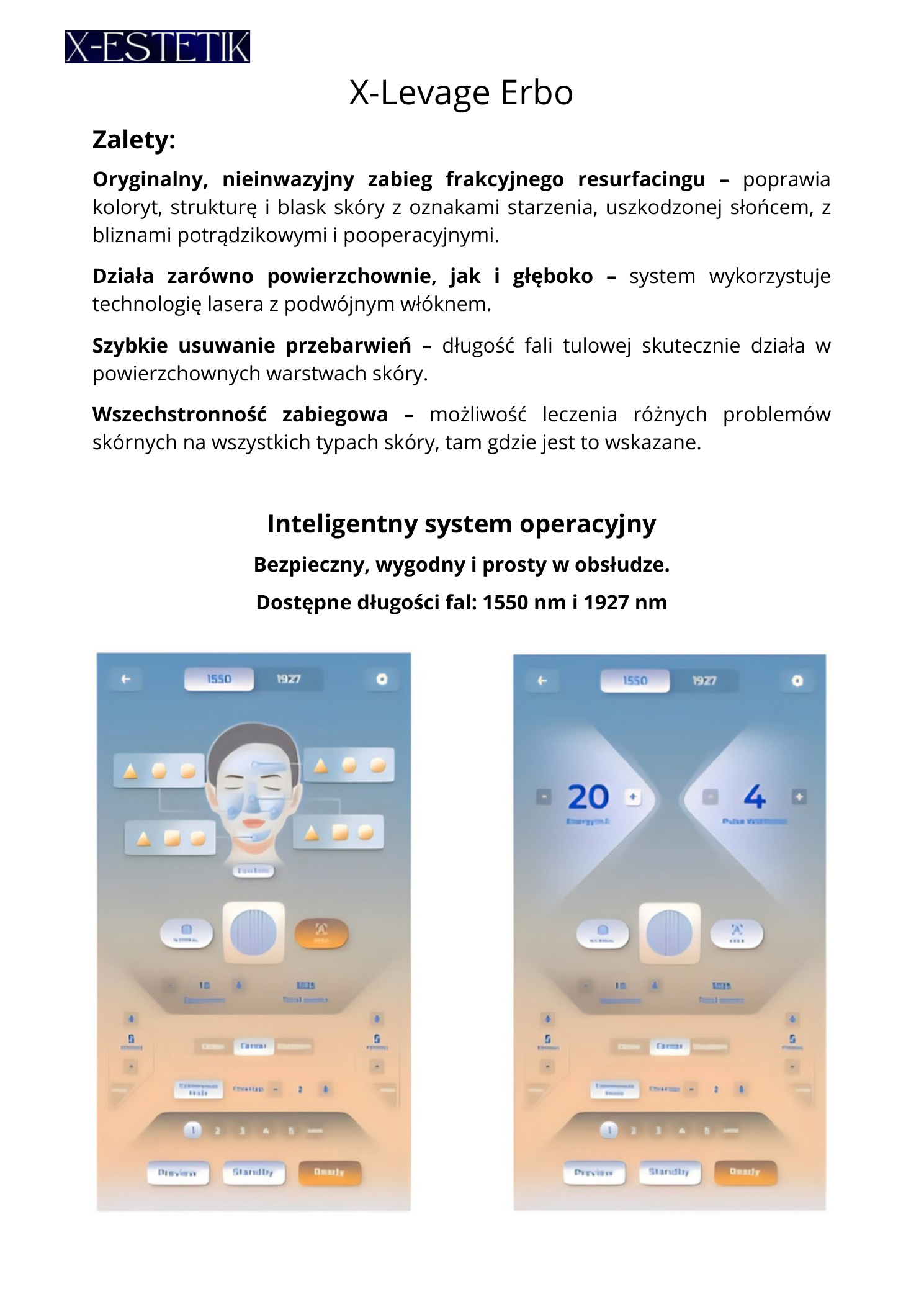 X‑Levage Erbo — zalety i system operacyjny