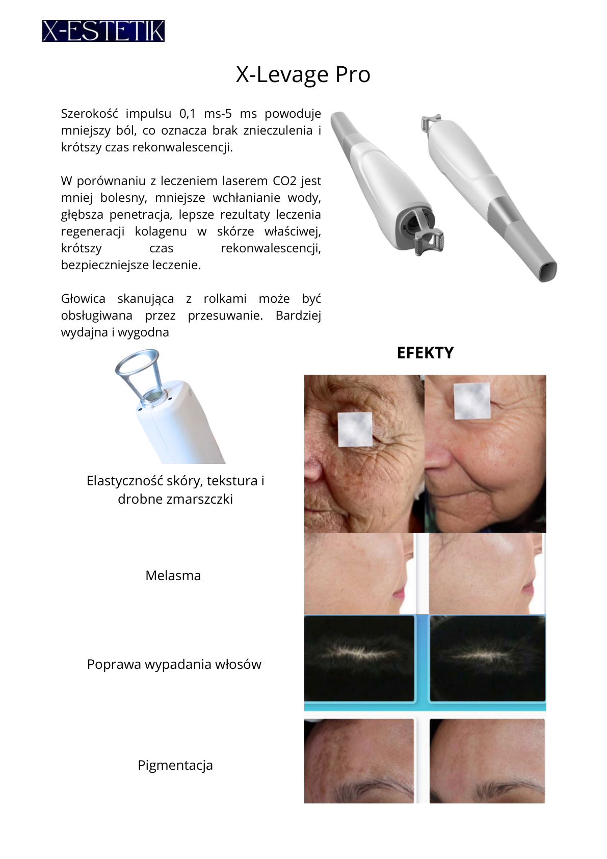 X‑Levage Pro — efekty